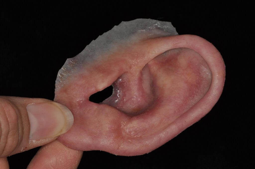 ear-prosthesis-2048x1360